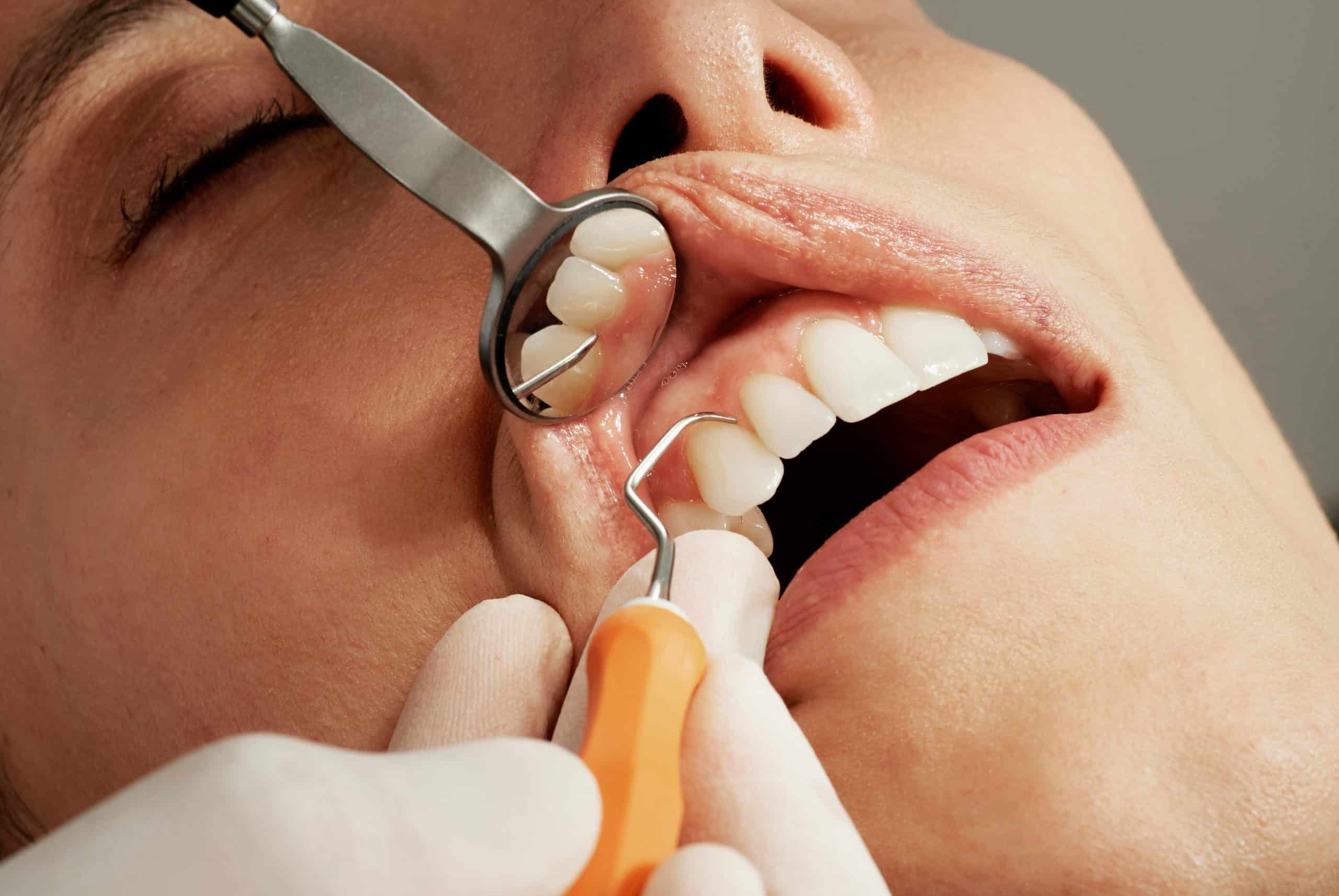 Dental treatment